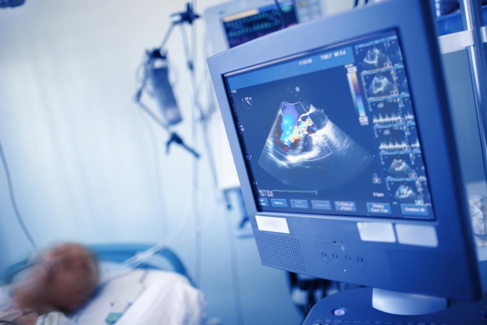 Echocardiogram showing aortic regurgitation